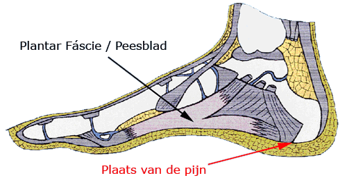 Goede sales schoenen hielspoor