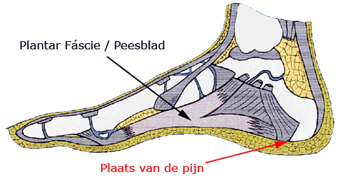 Wetland haai Verliefd Goede Schoenen Hielspoor Online - bvp-wankdorf.ch 1690531803